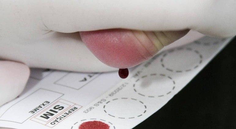 Dia Mundial das Doenças Raras: Brasil tem 13 milhões de diagnosticados