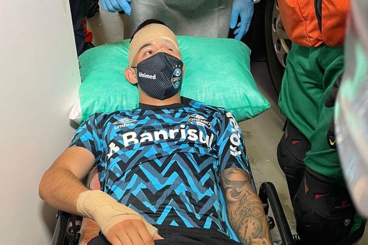 Federação gaúcha remarca Gre-Nal 435 para o dia 9 de março