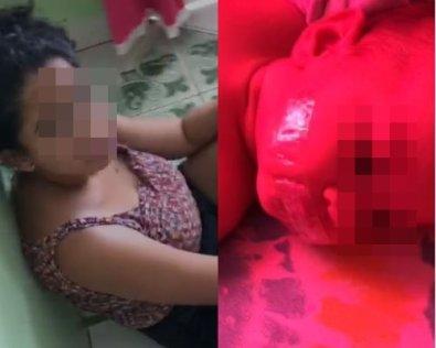 ABSURDO - Mãe cola fita adesiva para tapar a boca da filha de 6 meses em MT; veja vídeo