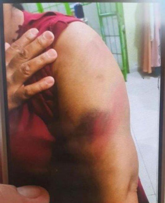 Justiça solta homem que espancou esposa por 3 dias com cinto em MT