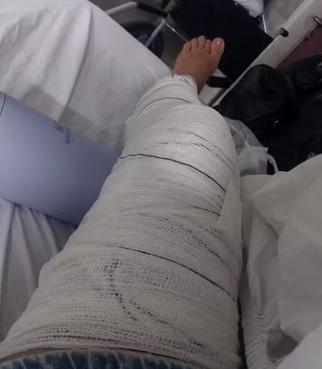 Comerciante tem fratura no joelho após vento arrancar cobertura de arquibancada na Stock Car em Cuiabá