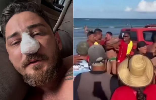 Veja o vídeo; Agredido em Porto de Galinhas passa por cirurgia em MT após identificar 4 fraturas no rosto
