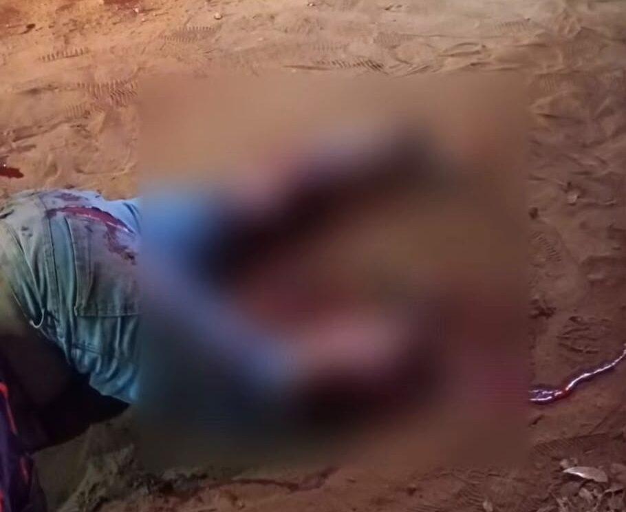 Primavera do Leste; Homem de 36 anos tem perna amputada após acidente