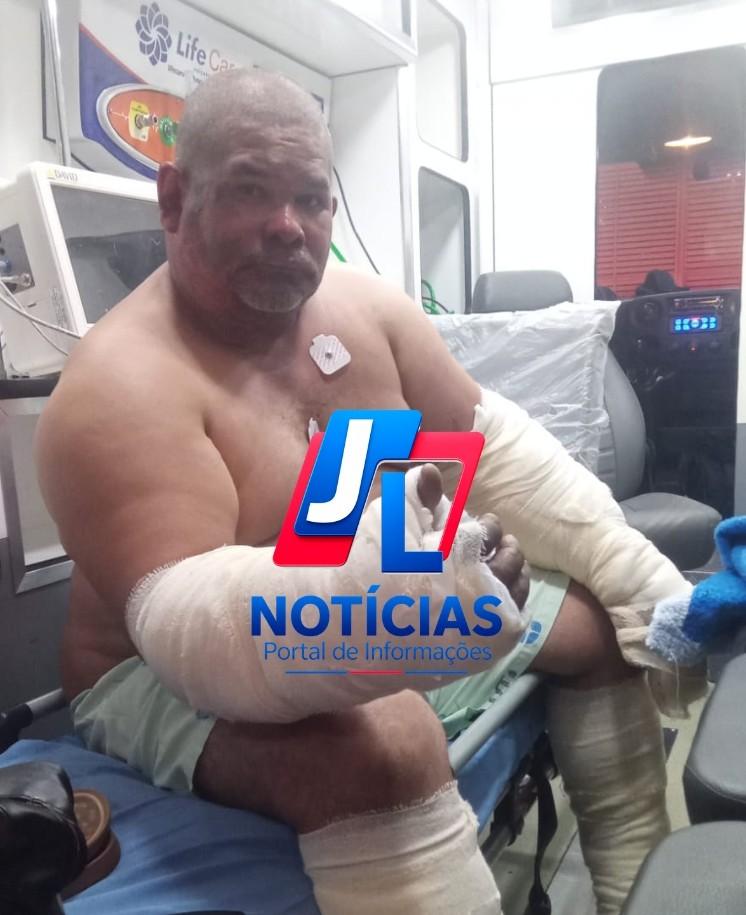 Exclusivo; Homem que ajudava a controlar fogo em Primavera está na UTI e precisa de ajuda