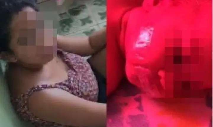 ABSURDO - Mãe cola fita adesiva para tapar a boca da filha de 6 meses em MT; veja vídeo