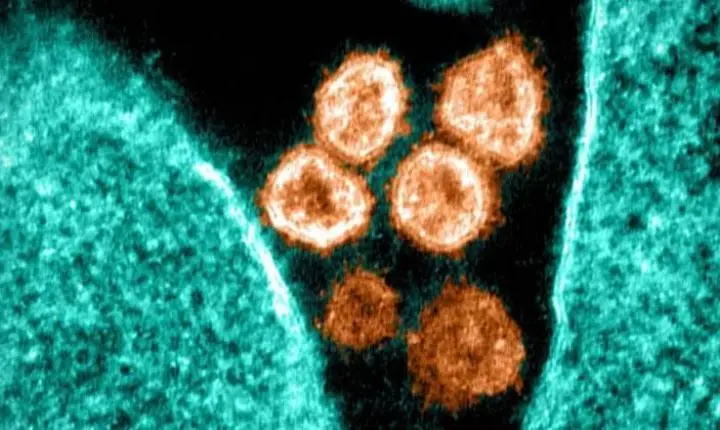 Cientistas descobrem método que impede totalmente a infecção pelo coronavírus