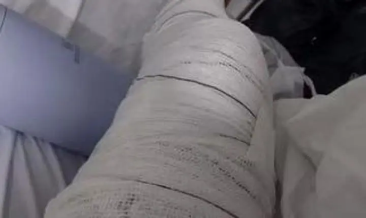 Comerciante tem fratura no joelho após vento arrancar cobertura de arquibancada na Stock Car em Cuiabá