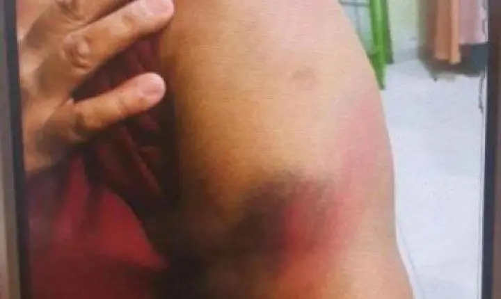 Justiça solta homem que espancou esposa por 3 dias com cinto em MT