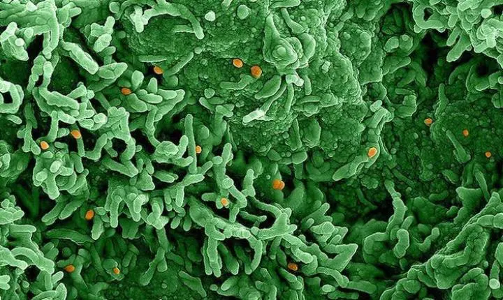 Rio Grande do Sul confirma 3º caso de varíola do macaco no Brasil