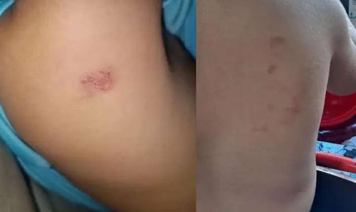 Sinop; Professora é afastada após mãe colocar gravador na mochila do filho e outra denunciar maus-tratos